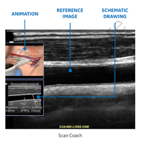 Introduction Training to Peripheral Vascular Doppler Ultrasound Study (Scanning Technique and Ultrasound Anatomy)