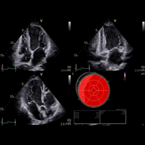Introduction Training to Myocardial Strain Imaging